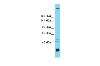 KIAA1551 Rabbit Polyclonal Antibody