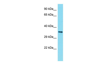 AMMECR1L Rabbit Polyclonal Antibody