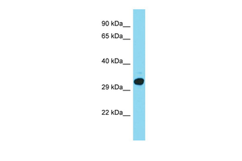 C15orf23 Rabbit Polyclonal Antibody