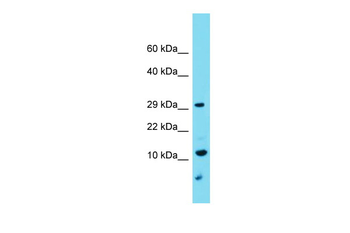 DMAC1 Rabbit Polyclonal Antibody