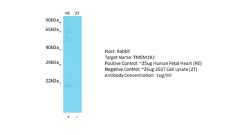 TMEM182 Rabbit Polyclonal Antibody