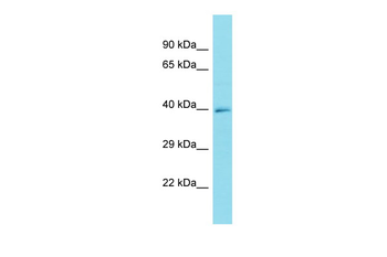 FRMD6-AS1 Rabbit Polyclonal Antibody