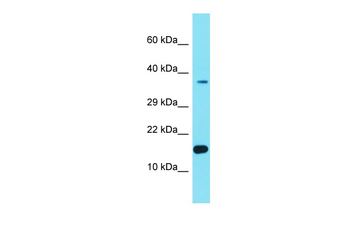 FER1L6-AS2 Rabbit Polyclonal Antibody