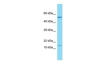 NATD1 Rabbit Polyclonal Antibody