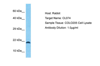 C12ORF74 Rabbit Polyclonal Antibody