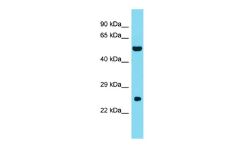 DNAAF3 Rabbit Polyclonal Antibody