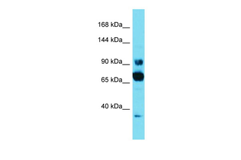 CCDC178 Rabbit Polyclonal Antibody