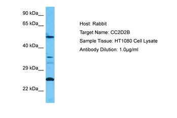 CC2D2B Rabbit Polyclonal Antibody