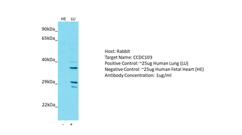 CCDC103 Rabbit Polyclonal Antibody