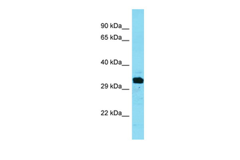 INKA1 Rabbit Polyclonal Antibody