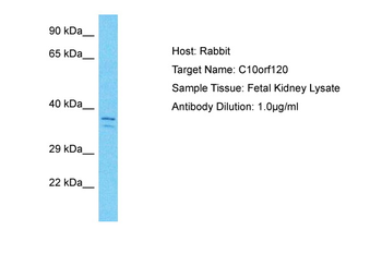 C10orf120 Rabbit Polyclonal Antibody