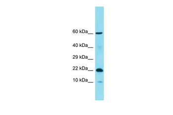 C11orf87 Rabbit Polyclonal Antibody