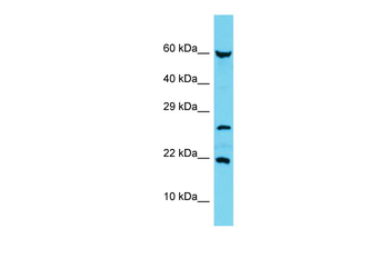 C17orf102 Rabbit Polyclonal Antibody