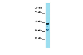 RGS7BP Rabbit Polyclonal Antibody