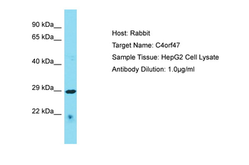 C4orf47 Rabbit Polyclonal Antibody