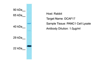 DCAF17 Rabbit Polyclonal Antibody