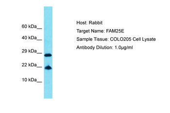 FAM25E Rabbit Polyclonal Antibody