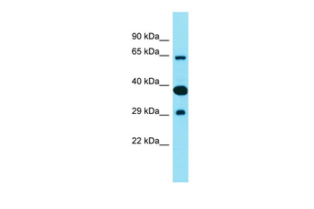 FAM83D Rabbit Polyclonal Antibody