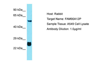 FAM90A10P Rabbit Polyclonal Antibody