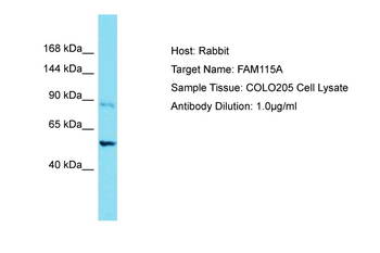 TCAF1 Rabbit Polyclonal Antibody