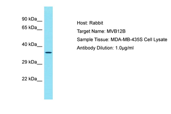 MVB12B Rabbit Polyclonal Antibody
