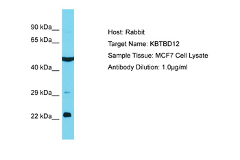 KBTBD12 Rabbit Polyclonal Antibody