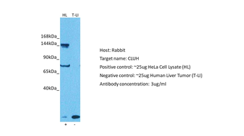 CLUH Rabbit Polyclonal Antibody