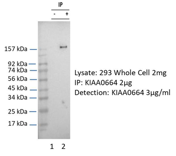 CLUH Rabbit Polyclonal Antibody