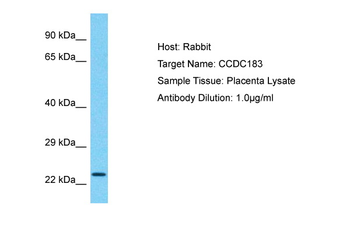 CCDC183 Rabbit Polyclonal Antibody