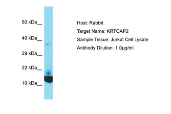 KRTCAP2 Rabbit Polyclonal Antibody