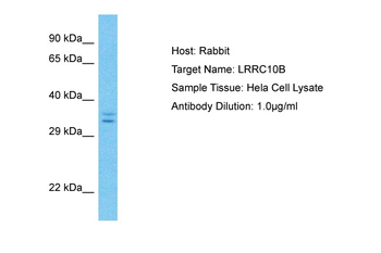 LRRC10B Rabbit Polyclonal Antibody