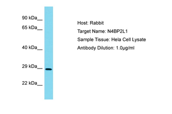 N4BP2L1 Rabbit Polyclonal Antibody