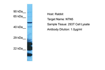 NTN5 Rabbit Polyclonal Antibody