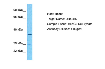 OR52B6 Rabbit Polyclonal Antibody
