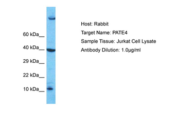 PATE4 Rabbit Polyclonal Antibody