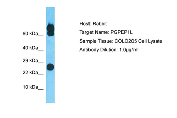PGPEP1L Rabbit Polyclonal Antibody