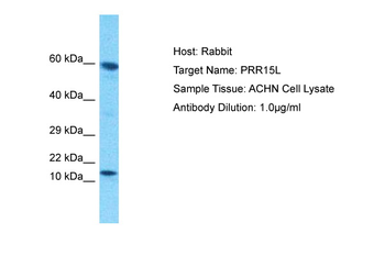 PRR15L Rabbit Polyclonal Antibody