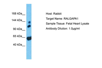 RALGAPA1 Rabbit Polyclonal Antibody