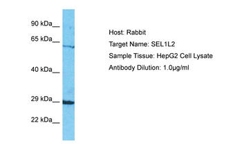 SEL1L2 Rabbit Polyclonal Antibody