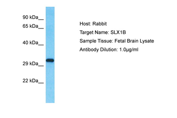 SLX1B Rabbit Polyclonal Antibody