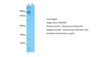 TMEM26 Rabbit Polyclonal Antibody