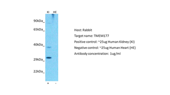 TMEM177 Rabbit Polyclonal Antibody