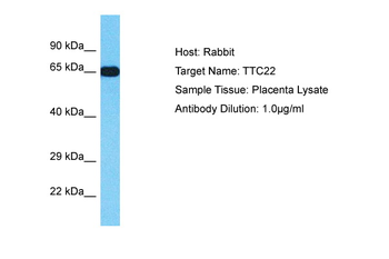 TTC22 Rabbit Polyclonal Antibody