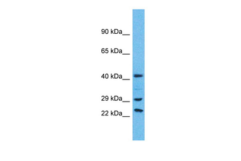 USP41 Rabbit Polyclonal Antibody