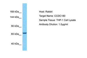 CCDC180 Rabbit Polyclonal Antibody