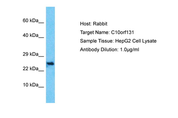 C10orf131 Rabbit Polyclonal Antibody