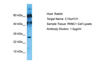 C10orf131 Rabbit Polyclonal Antibody