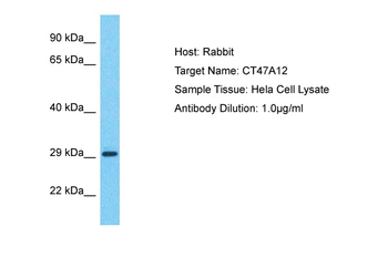 CT47A12 Rabbit Polyclonal Antibody