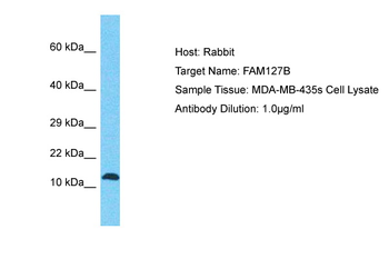 RTL8A Rabbit Polyclonal Antibody
