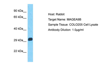 MAGEA9B Rabbit Polyclonal Antibody